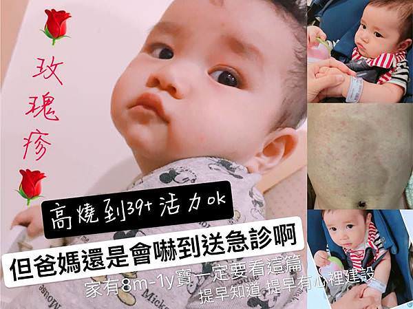 玫瑰疹111.jpg